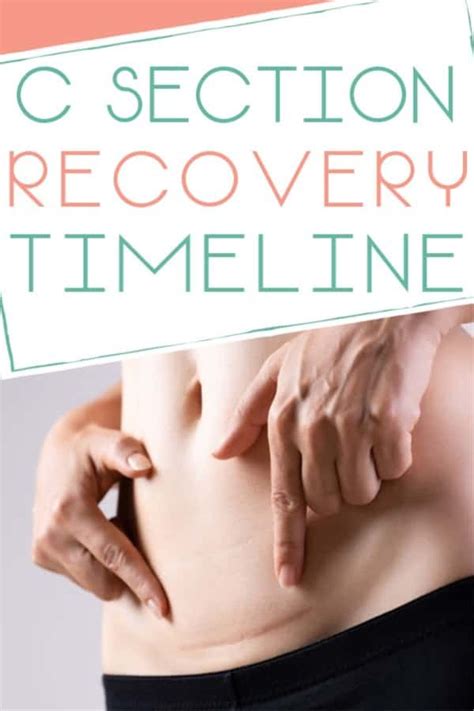 C Section Recovery Timeline A Week By Week Look At Recovery Artofit