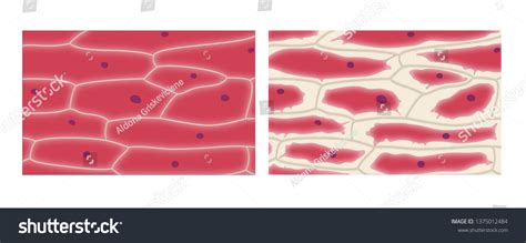 Plasmolysis Onion Epidermis Cells Stock Illustration 1375012484