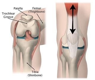 Knee Cap Exercises: Improve Patella Tracking - Knee Pain Explained