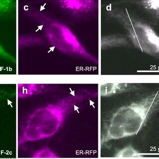 Fluorescence Co Localization Images Of Live HeLa Cells Stained With