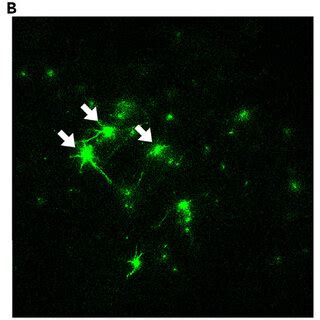 Two Photon Imaging Of Spontaneous Neuronal Activity Two Photon Images