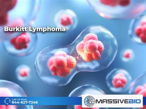 Burkitt Lymphoma - Symptoms of Burkitt Lymphoma