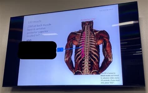 Neuro Lab Exam Flashcards Quizlet