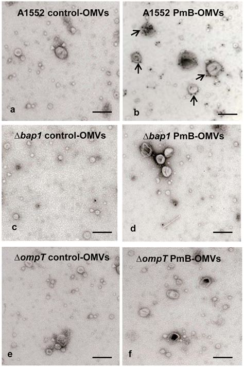 Immuno Gold Labeling And Electron Microscopic Analysis Of LL 37 Binding