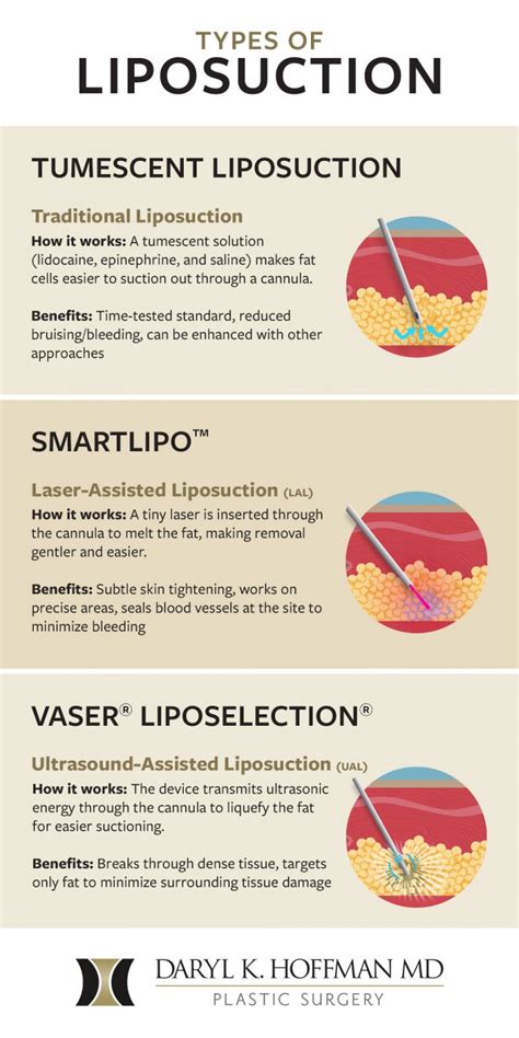 3 Different Types Of Liposuction Which Is Best For You Infographic Updated 2023 Daryl