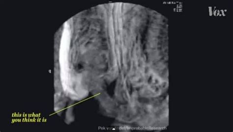 Yes You Want To Know What Sex In An MRI Scanner Looks Like