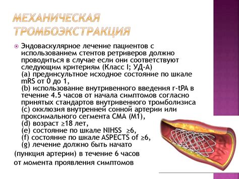 Тромболизисная терапия - презентация онлайн