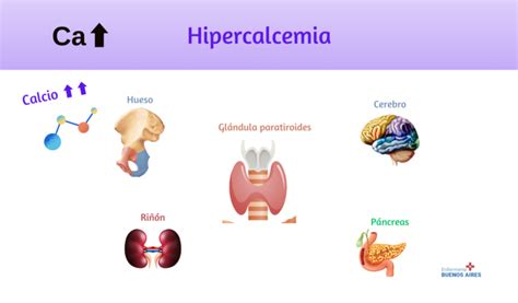 Guía Completa Sobre La Hipercalcemia Causas Síntomas Y Tratamiento 2024