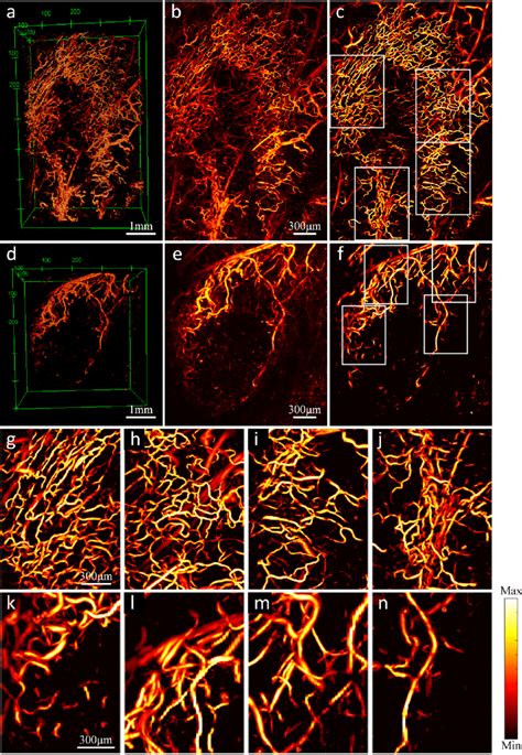 Segmentation Of Tumor Vessel Using 3d Hsm A C The 3d Images Map