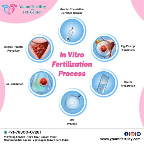 Yaami Fertility Best Ivf Center And Ivf Solution In Indo… Flickr