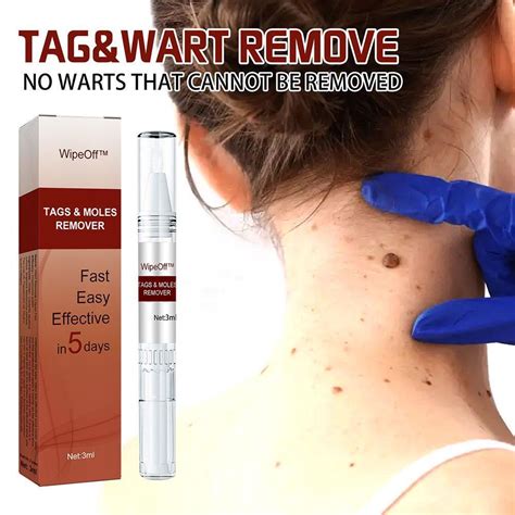 Wipeoff Tags Moles Remover Wipeoff Tags Moles Remove Quick Saf EBay