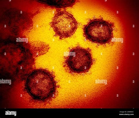 Esta Imagen Del Microscopio Electr Nico De Transmisi N Muestra El Sars