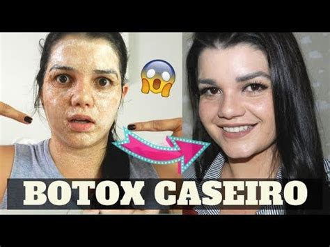 BOTOX CASEIRO PARA ACABAR LINHAS DE EXPRESSÃO RUGAS E BIGODE CHINÊS