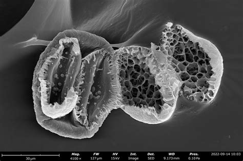 Scanning Electron Microscopy Contrast