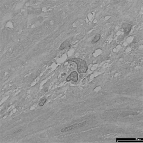 In Situ Hybridization For Mrna Encoding Sex Hormonebinding Globulin In Download Scientific