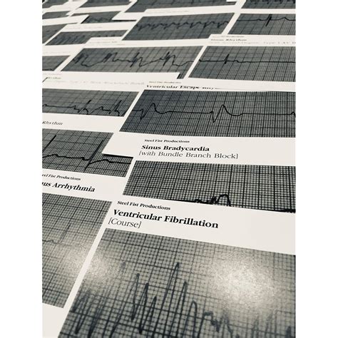 Snapklik EKG ECG Cardiac Acls Rhythm Strip Flashcards