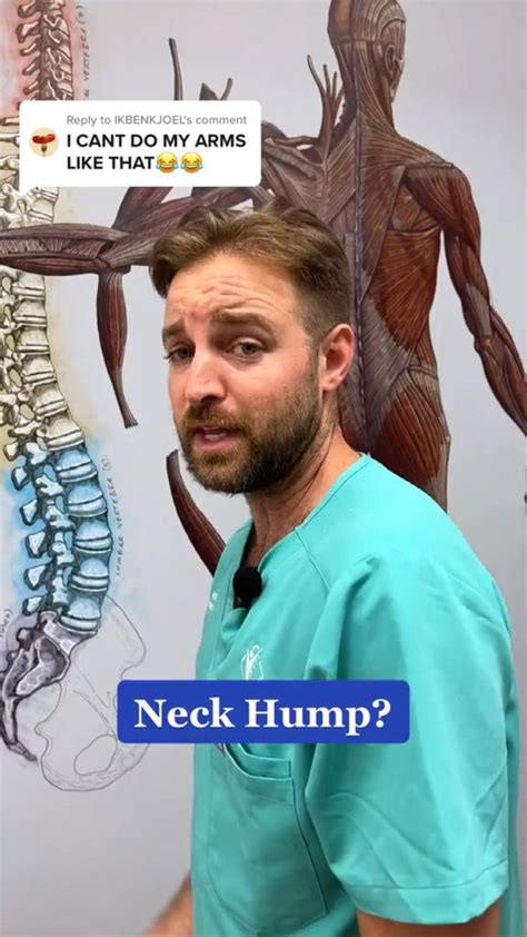 Easy Neck Hump Fix You Have To Try At Home Posture Correction