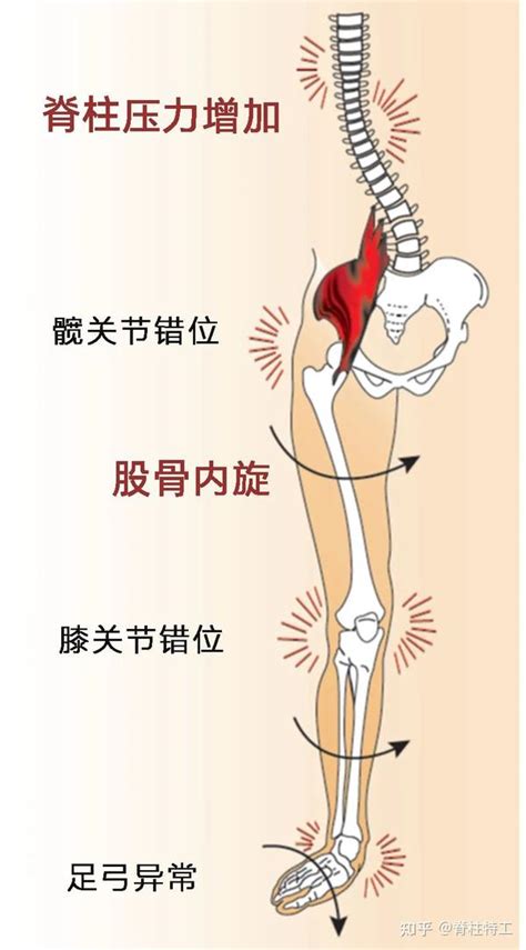 你的“假胯宽”留不住了！ 知乎