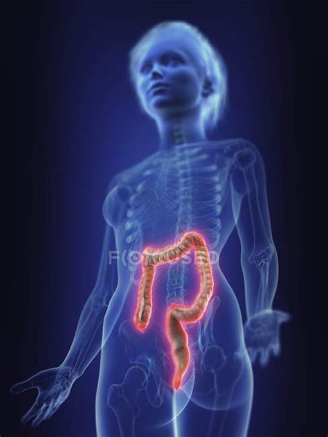 Illustration Of Human Silhouette With Inflamed Colon Peptic