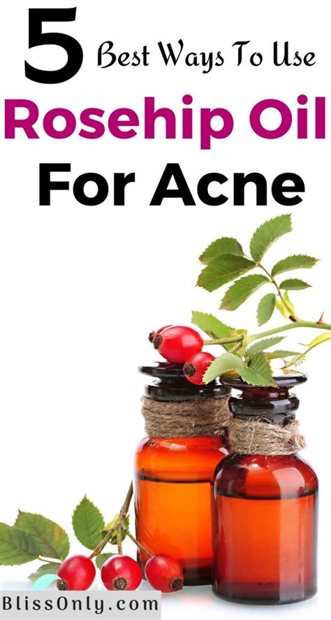 5 Best Ways To Use Rosehip Oil For Acne - BlissOnly