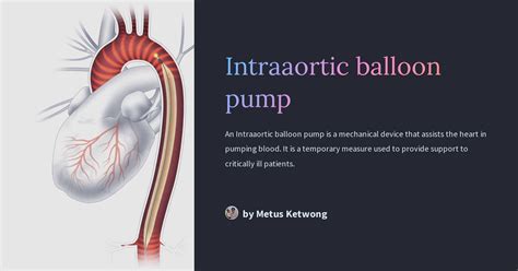 Intraaortic Balloon Pump