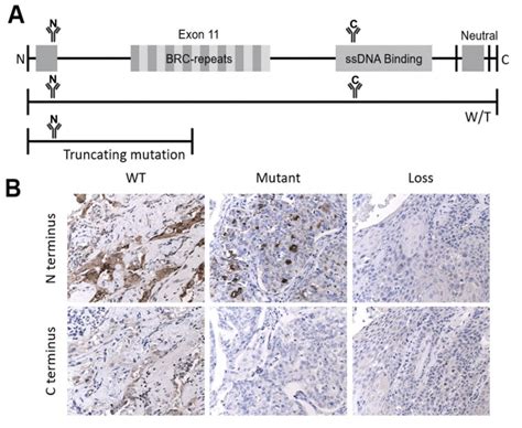 Schematic Showing Immunohistochemical Staining Of Brca Protein Using