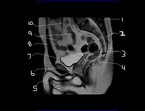 Gi Test 2 Cross Sectional Anatomy Pt4 Diagram Quizlet