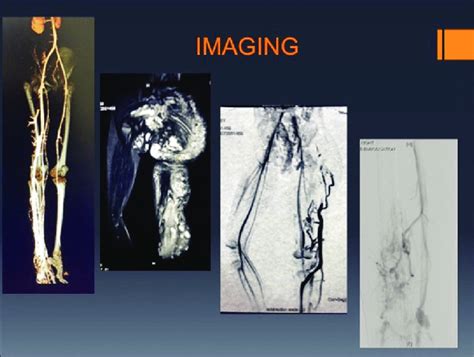 Imaging In Klippel Trenaunay Syndrome Download Scientific Diagram