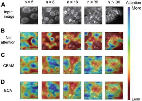 Frontiers Neuroseg Ii A Deep Learning Approach For Generalized