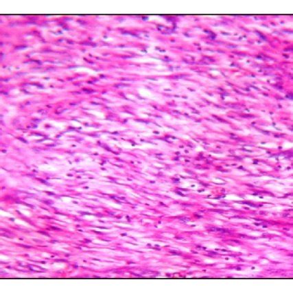 Histology of the omentum. (a) H&E ×100 magnification of omental tissue... | Download Scientific ...