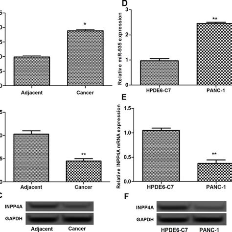 Inverse Expression Of MiR 935 And INPP4A In Pancreatic Cancer Tissues