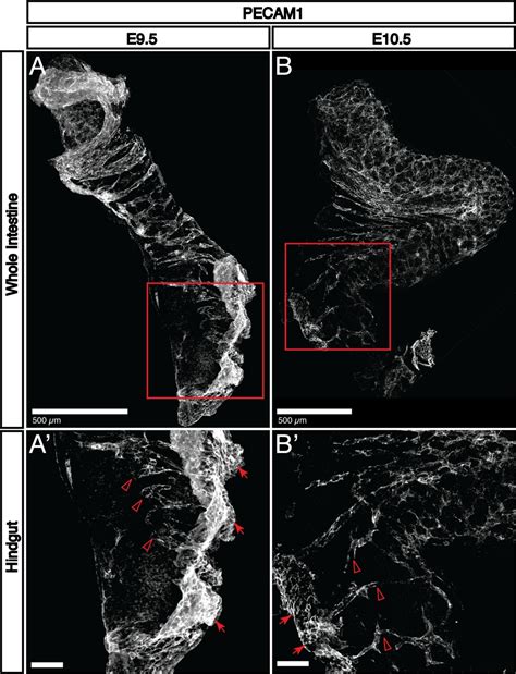 Spatiotemporal Mapping Of Vascularization And Innervation In The Fetal