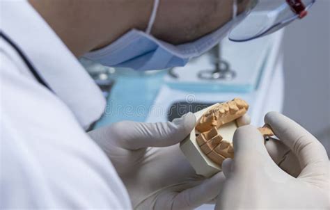 Dental Prosthesis for Implant. Stock Image - Image of insert, procedure ...