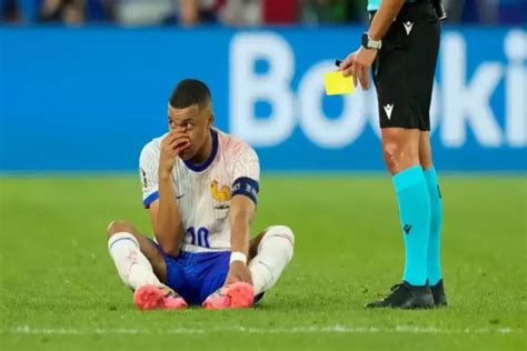 Hidung Kylian Mbappe Patah Ketika Lawan Austria Hal Ini Kondisi Terbarunya