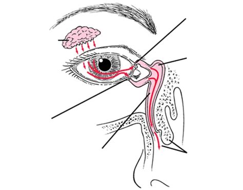 Lacrimal Duct Quiz