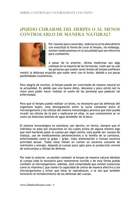 Reporte Para Controlar El Herpes Naturalmente PDF