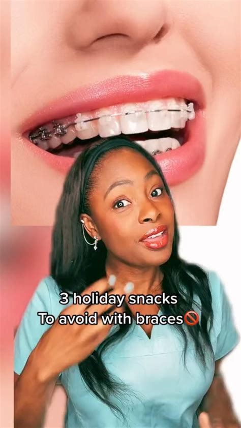 Braces Colors Dentalhygienist Bracescolors Braces Artofit