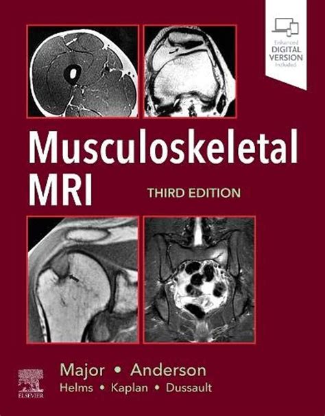 Musculoskeletal Mri