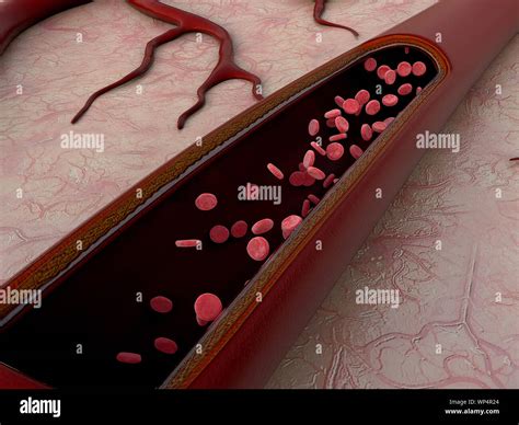 Blood Vessels Micrograph Hi Res Stock Photography And Images Alamy