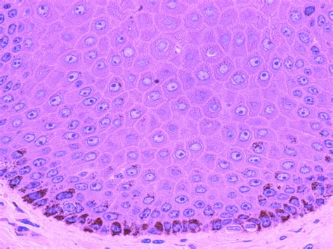 Stratum Basale and Stratum Spinosum