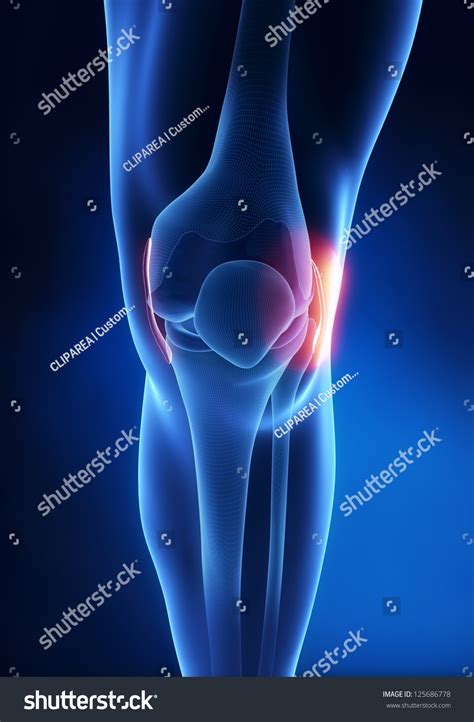 Stock Ilustrace „lateral Collateral Ligament Knee Injury 125686778