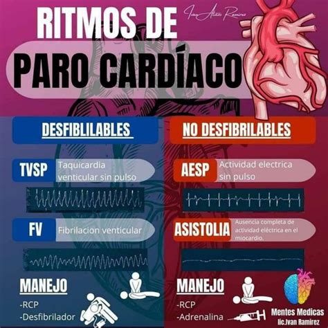 Ritmos De Paro Cardiaco Yudoc Org Udocz