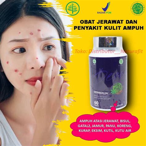 Jual Dermaklin Obat Jamur Kulit Jerawat Gatal Kurap Koreng Panu Kutil