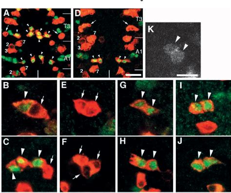 Figure 3 From Mechanism Of Glia Neuron Cell Fate Switch In The