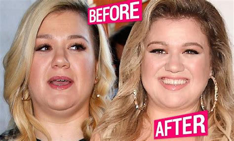 Kelly Clarkson Loses Weight Before And After Pics