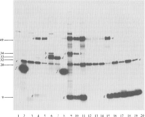 Fluorogram Of The 35s Methionine Labelled Polypeptides Expressed From