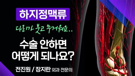 다리에 핏줄이 튀어나오지 않아도 하지정맥일 수 있다 방치하면 더 심해지는 하지정맥류 부산mbc 메디컬다큐365