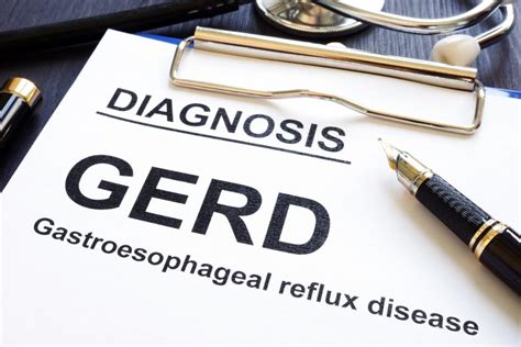 Comprehensive Guide To Managing Gerd Effective Treatments And