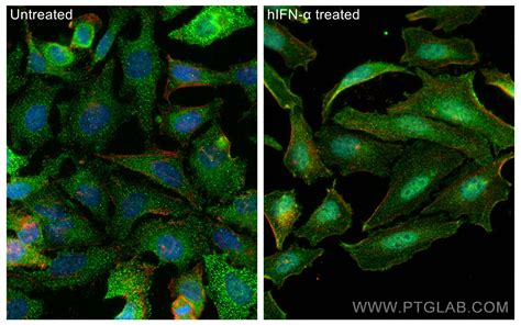 Phospho Stat1 Tyr701 Antibody 28979 1 Ap Proteintech