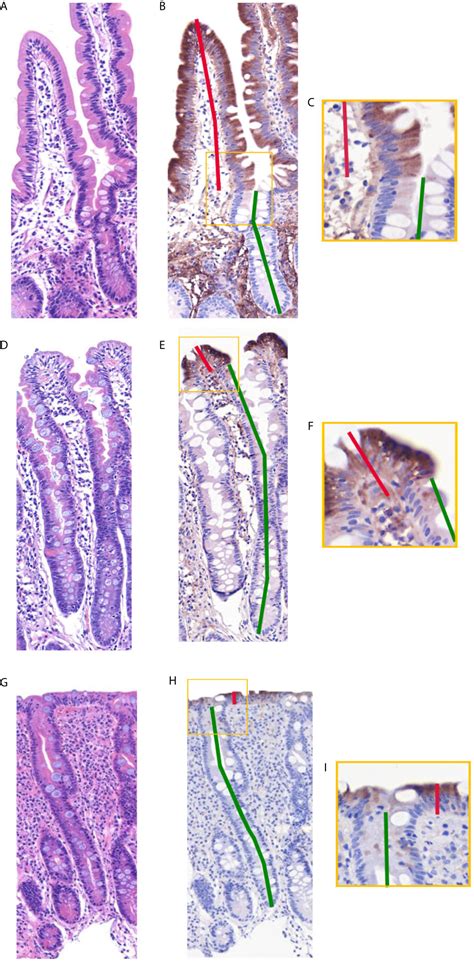 Frontiers Apolipoprotein A4 Defines The Villus Crypt Border In